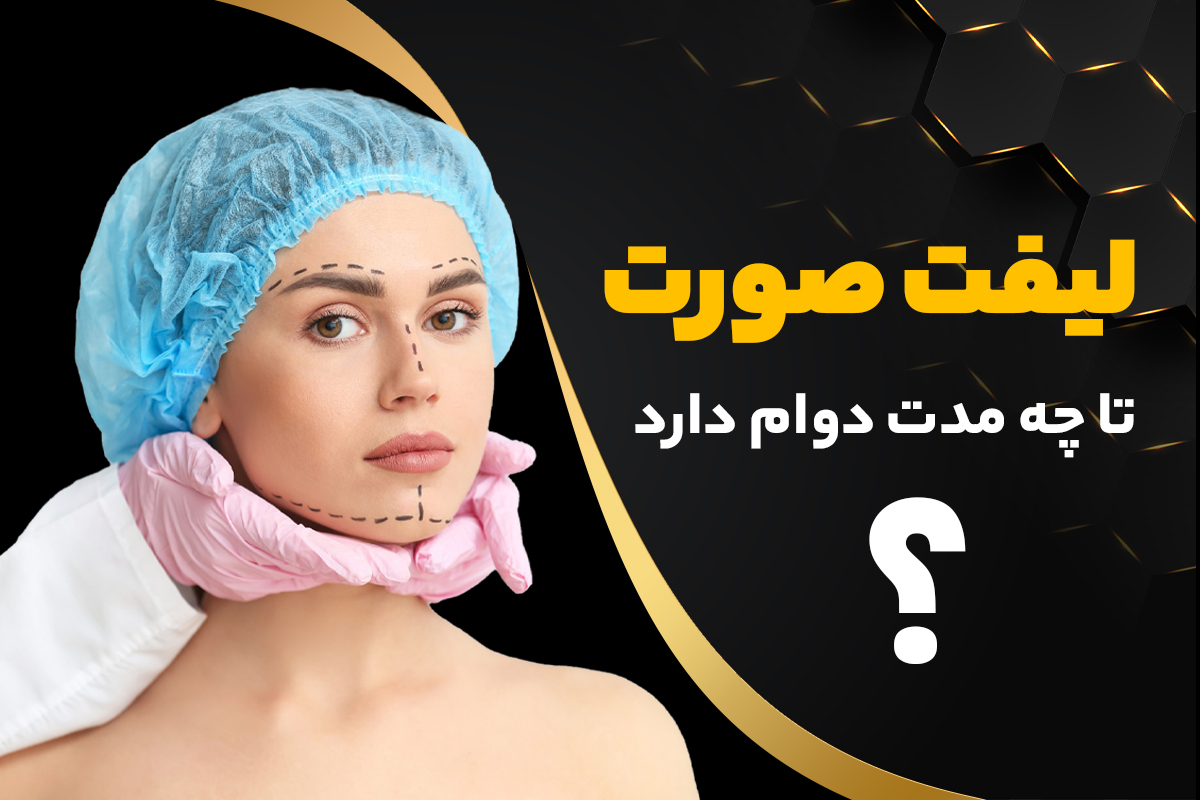 ماندگاری لیفت صورت