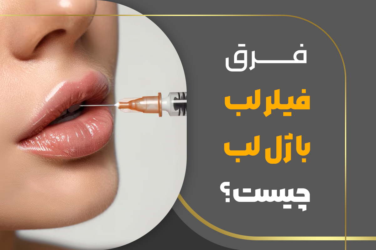 فرق فیلر لب با ژل لب